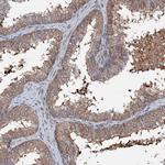 FLYWCH1 Antibody in Immunohistochemistry (Paraffin) (IHC (P))
