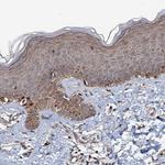 FLYWCH1 Antibody in Immunohistochemistry (Paraffin) (IHC (P))