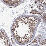 FSIP1 Polyclonal Antibody