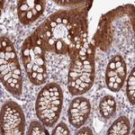 CES3 Polyclonal Antibody