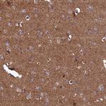 UBE3B Antibody in Immunohistochemistry (Paraffin) (IHC (P))