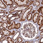 UBE3B Antibody in Immunohistochemistry (Paraffin) (IHC (P))