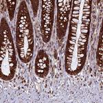 UBE3B Antibody in Immunohistochemistry (Paraffin) (IHC (P))