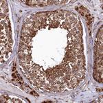 UBE3B Antibody in Immunohistochemistry (Paraffin) (IHC (P))