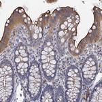 ACSM3 Polyclonal Antibody