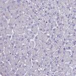 ACSS1 Antibody in Immunohistochemistry (Paraffin) (IHC (P))