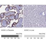 ACSS1 Antibody in Immunohistochemistry (IHC)