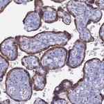 ACSS1 Antibody in Immunohistochemistry (IHC)