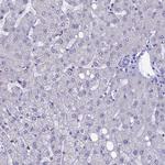 ACSS1 Antibody in Immunohistochemistry (IHC)