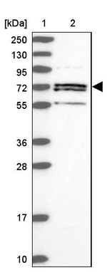 ACSS1 Antibody in Western Blot (WB)