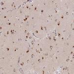 STX16 Antibody in Immunohistochemistry (Paraffin) (IHC (P))