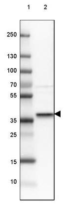 STX16 Antibody in Western Blot (WB)