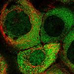 KIAA1609 Antibody in Immunocytochemistry (ICC/IF)