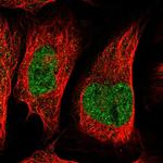 C20orf177 Polyclonal Antibody