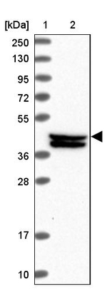 C20orf177 Antibody in Western Blot (WB)