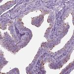 FAM92B Polyclonal Antibody