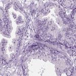 FAM92B Antibody in Immunohistochemistry (IHC)