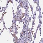 IGSF6 Antibody in Immunohistochemistry (Paraffin) (IHC (P))