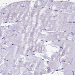 IGSF6 Antibody in Immunohistochemistry (Paraffin) (IHC (P))
