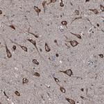 SLC25A38 Polyclonal Antibody