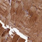 NCKAP5L Antibody in Immunohistochemistry (Paraffin) (IHC (P))