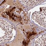 NCKAP5L Antibody in Immunohistochemistry (Paraffin) (IHC (P))