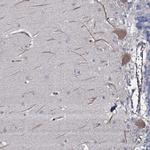 TMEM151A Antibody in Immunohistochemistry (Paraffin) (IHC (P))