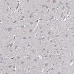 TMEM151A Antibody in Immunohistochemistry (Paraffin) (IHC (P))