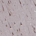 TMEM151A Antibody in Immunohistochemistry (Paraffin) (IHC (P))