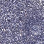 TMEM151A Polyclonal Antibody