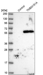 TMEM151A Antibody in Western Blot (WB)