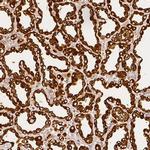Beta-casein Antibody in Immunohistochemistry (IHC)