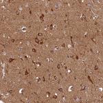 STX12 Antibody in Immunohistochemistry (Paraffin) (IHC (P))