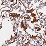 STX12 Antibody in Immunohistochemistry (Paraffin) (IHC (P))