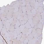 STX12 Antibody in Immunohistochemistry (Paraffin) (IHC (P))