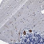 LRRC30 Polyclonal Antibody