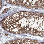 C2orf44 Antibody in Immunohistochemistry (Paraffin) (IHC (P))