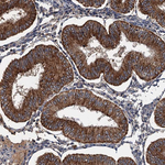 C2orf44 Antibody in Immunohistochemistry (Paraffin) (IHC (P))