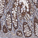 C2orf44 Antibody in Immunohistochemistry (Paraffin) (IHC (P))