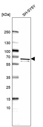 C2orf44 Antibody in Western Blot (WB)