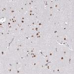 hnRNP U Antibody in Immunohistochemistry (Paraffin) (IHC (P))