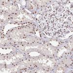 hnRNP U Antibody in Immunohistochemistry (Paraffin) (IHC (P))