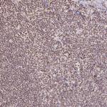 hnRNP U Antibody in Immunohistochemistry (Paraffin) (IHC (P))