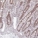 hnRNP U Antibody in Immunohistochemistry (Paraffin) (IHC (P))