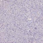 IL18BP Antibody in Immunohistochemistry (IHC)