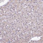 HECTD4 Antibody in Immunohistochemistry (Paraffin) (IHC (P))