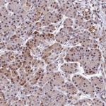 HECTD4 Antibody in Immunohistochemistry (Paraffin) (IHC (P))
