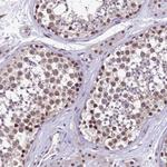 HECTD4 Antibody in Immunohistochemistry (Paraffin) (IHC (P))