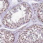 HECTD4 Antibody in Immunohistochemistry (IHC)