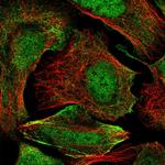 ZC3H4 Polyclonal Antibody